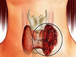 1542079231224388.jpg f6988d9d83b1f27aeffc2da1967e151a.jpg